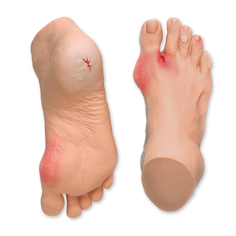 Pathologies du pied fréquentes