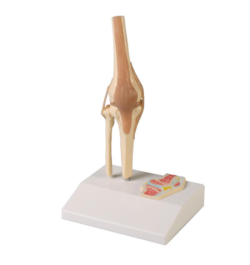 Mini modèle d’articulation du genou en coupe
