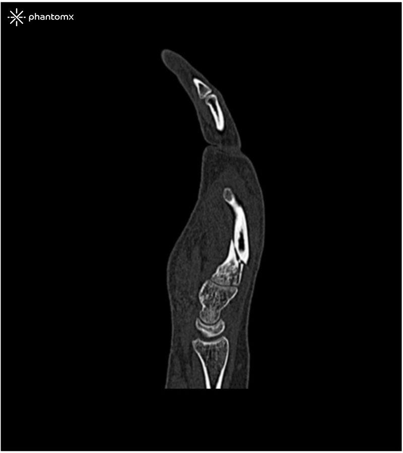 Handphantom-für-CT-Röntgen-und-Strahlentherapie-2