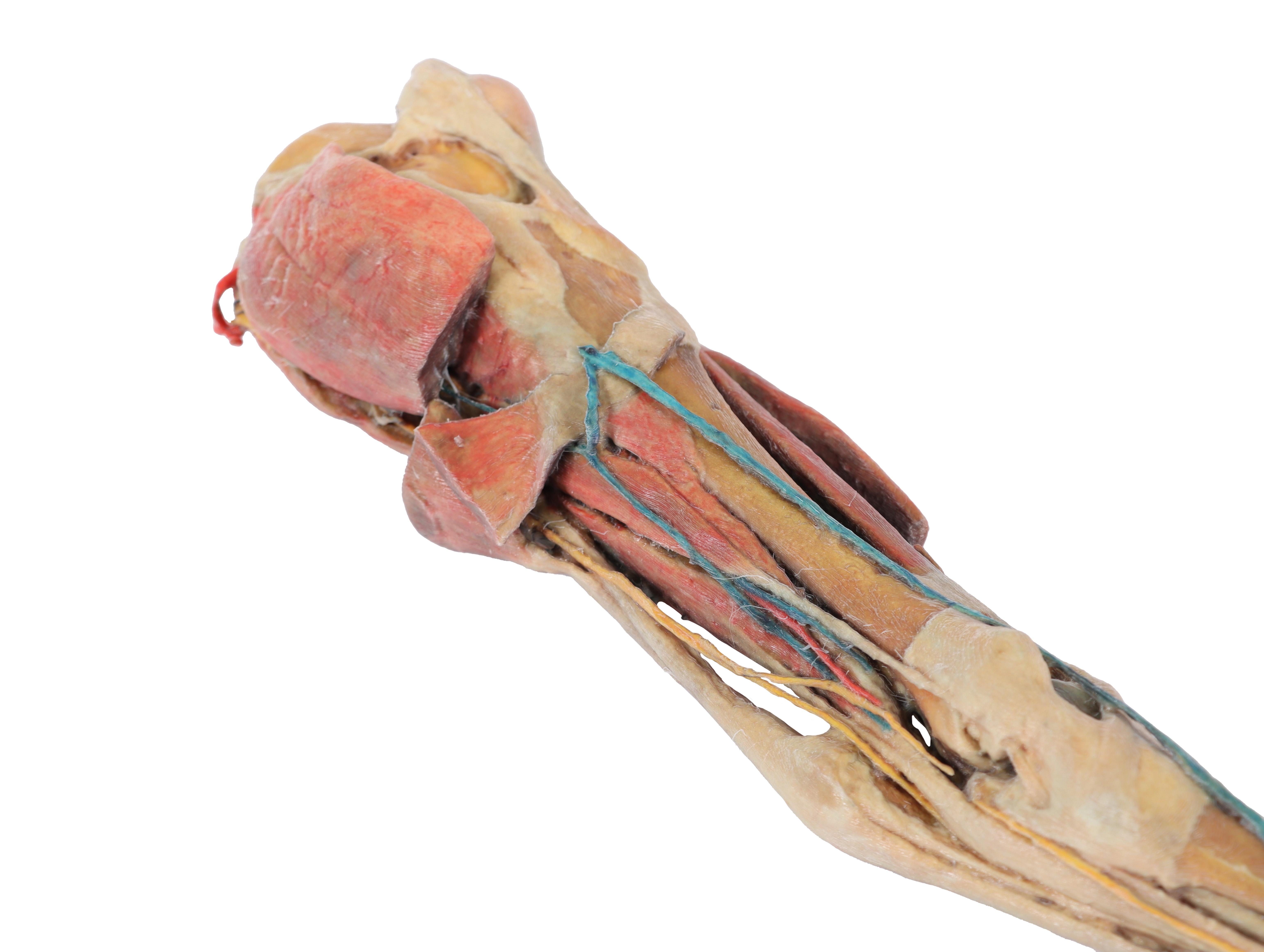 Horse-hindlimb---muscles,-tendons,-ligaments,-vessels-and-nerves-distal-to-the-stifle-3