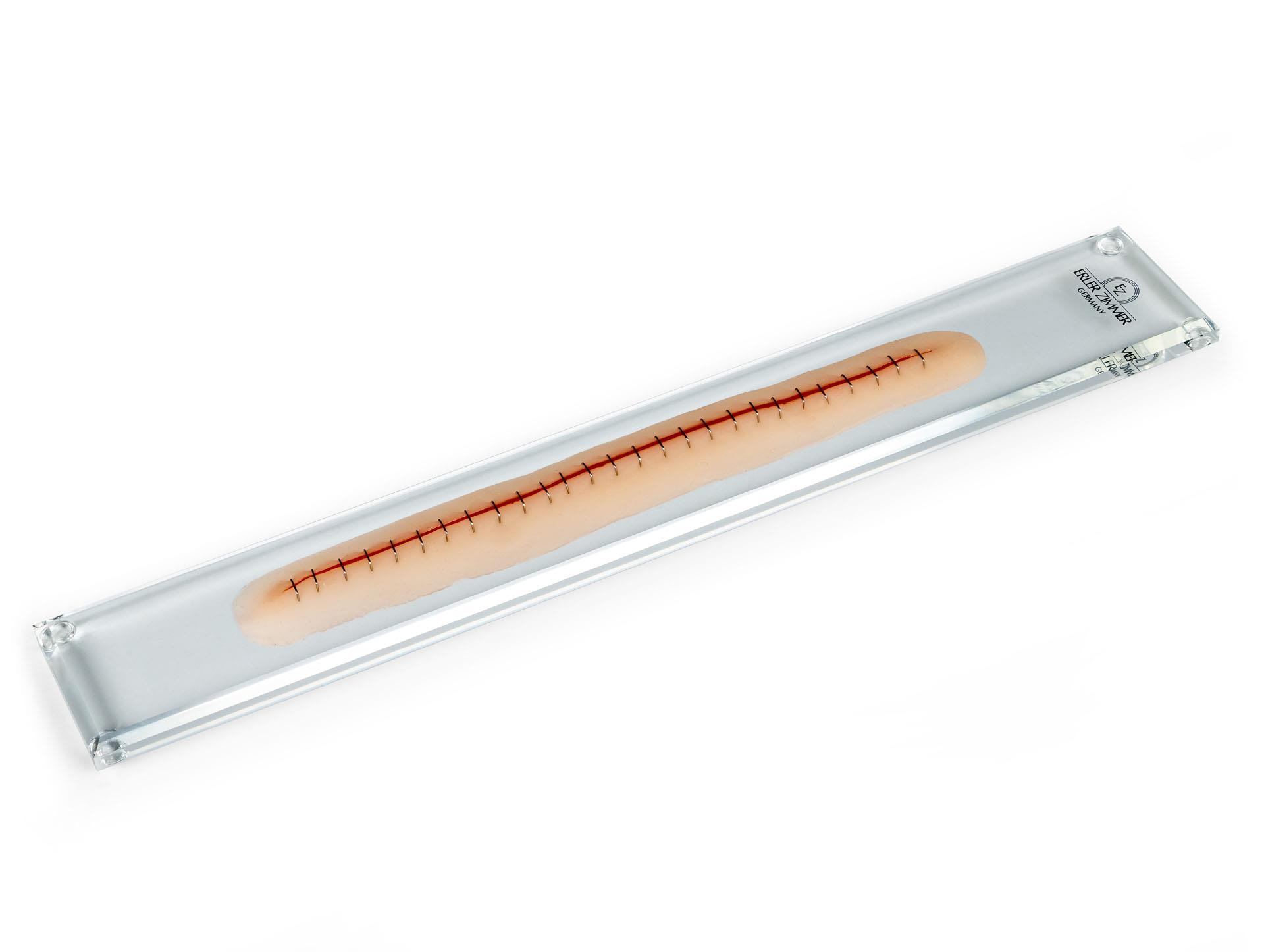 Surgical-wound-with-staples-22cm