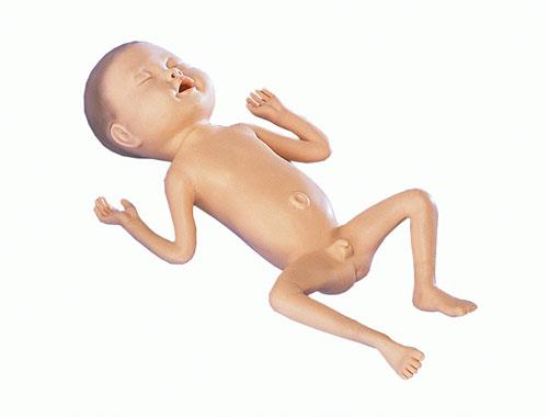 Frühgeborenen-Modell, 24 Wochen alt