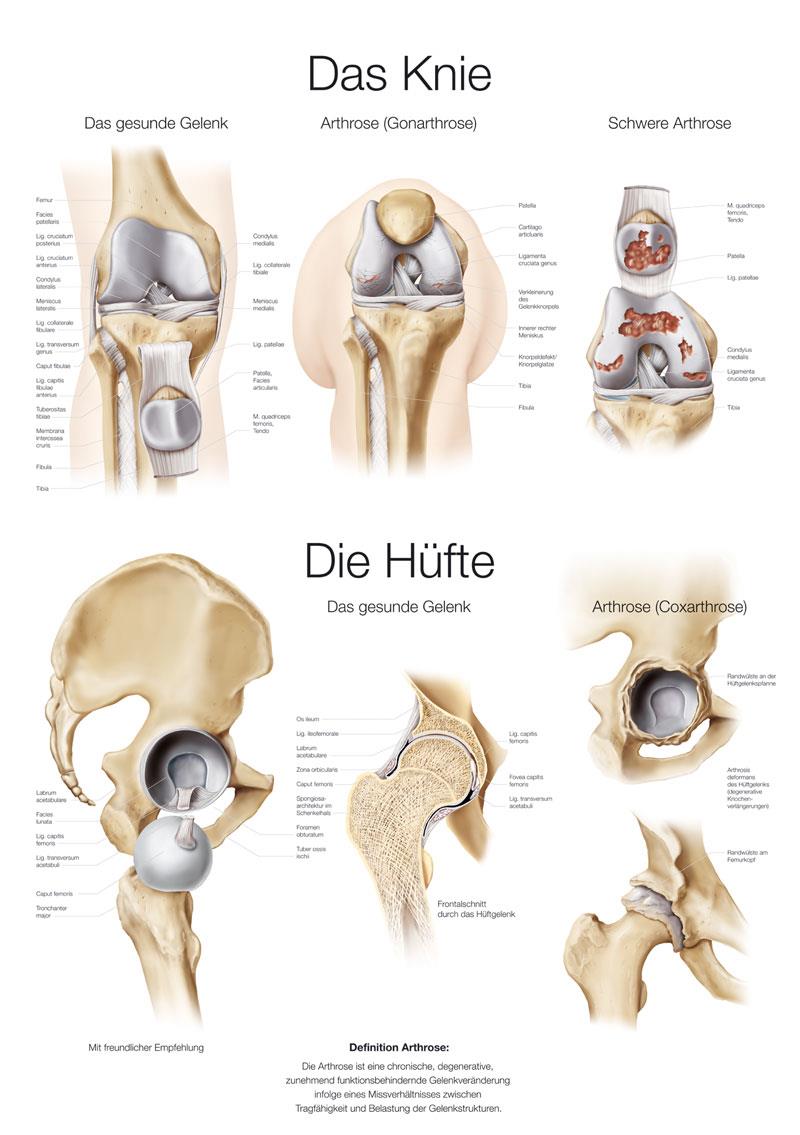 Chart The knee / The hip (german), 70x100cm