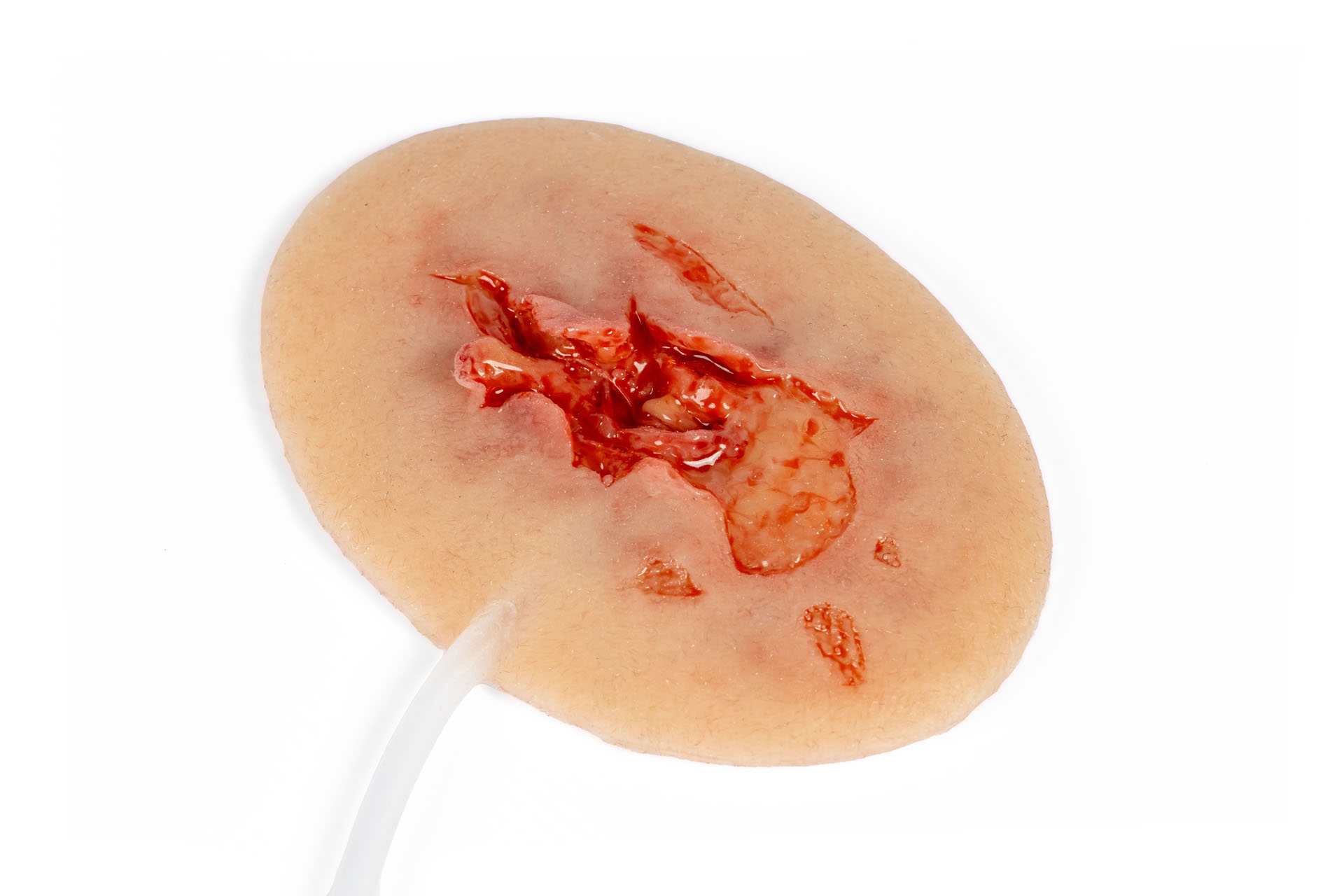 Wound moulage axillary injury