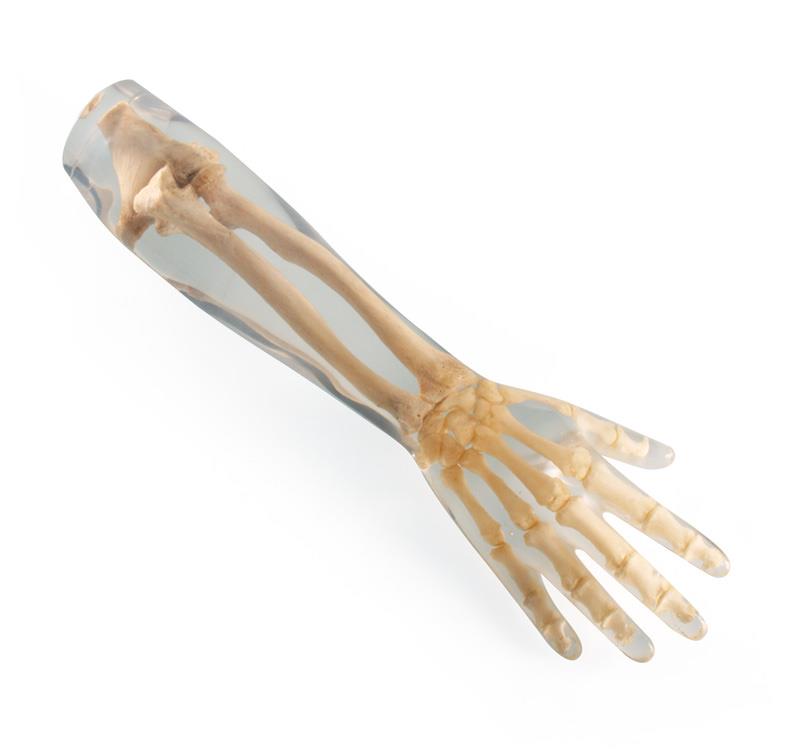 X-Ray Phantom Lower Arm, transparent