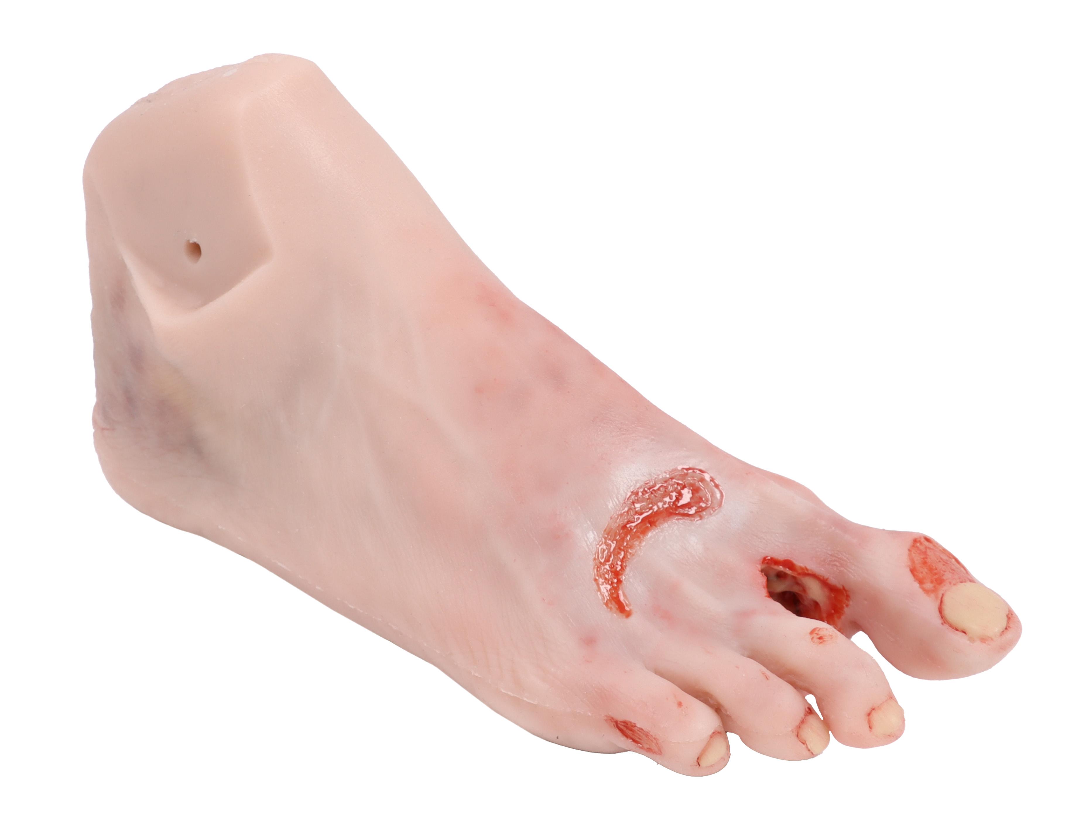 Wound-foot-with-diabetic-foot-syndrome-severe-stage-manikin-version