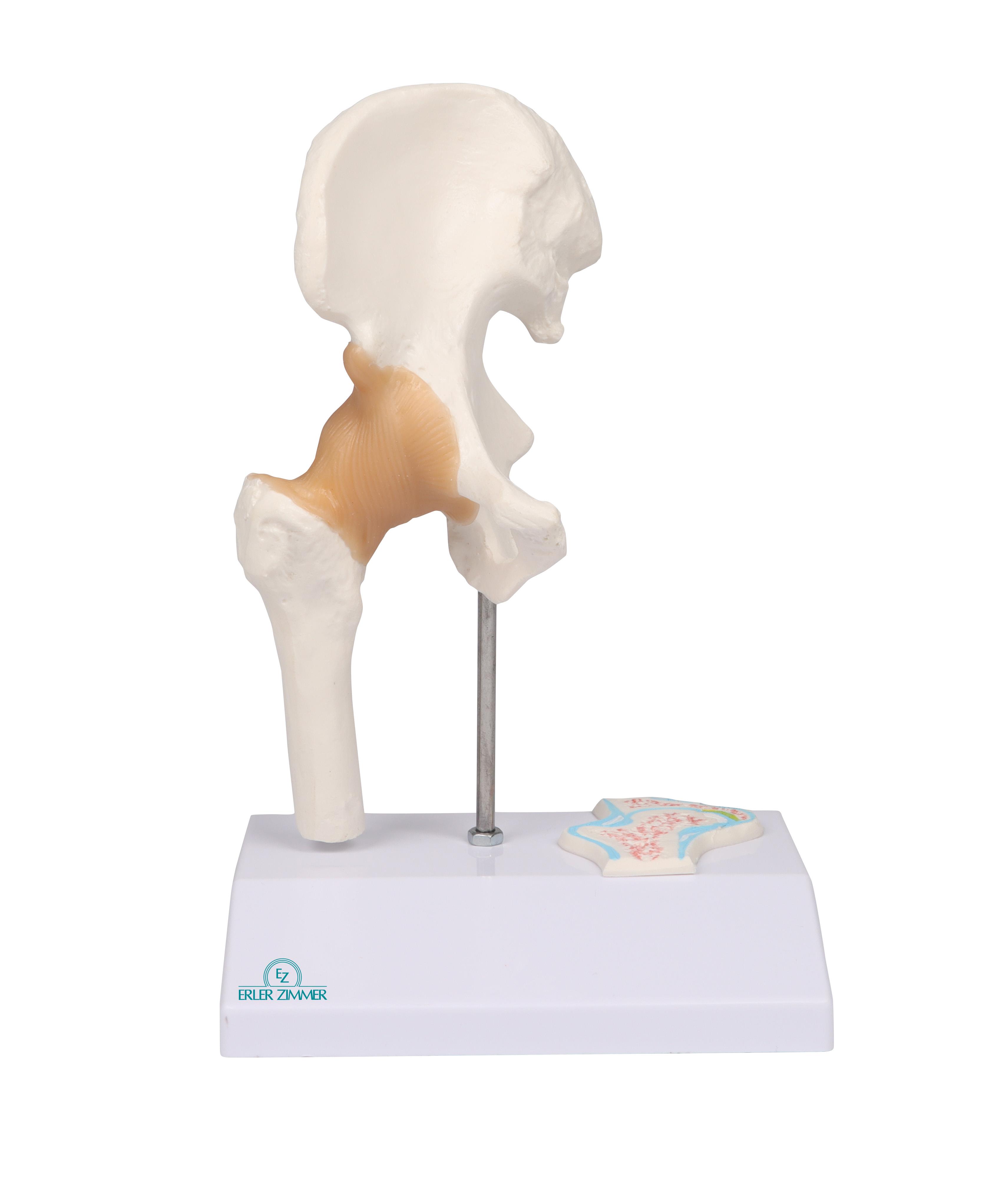 Mini modèle d’articulation de la hanche en coupe