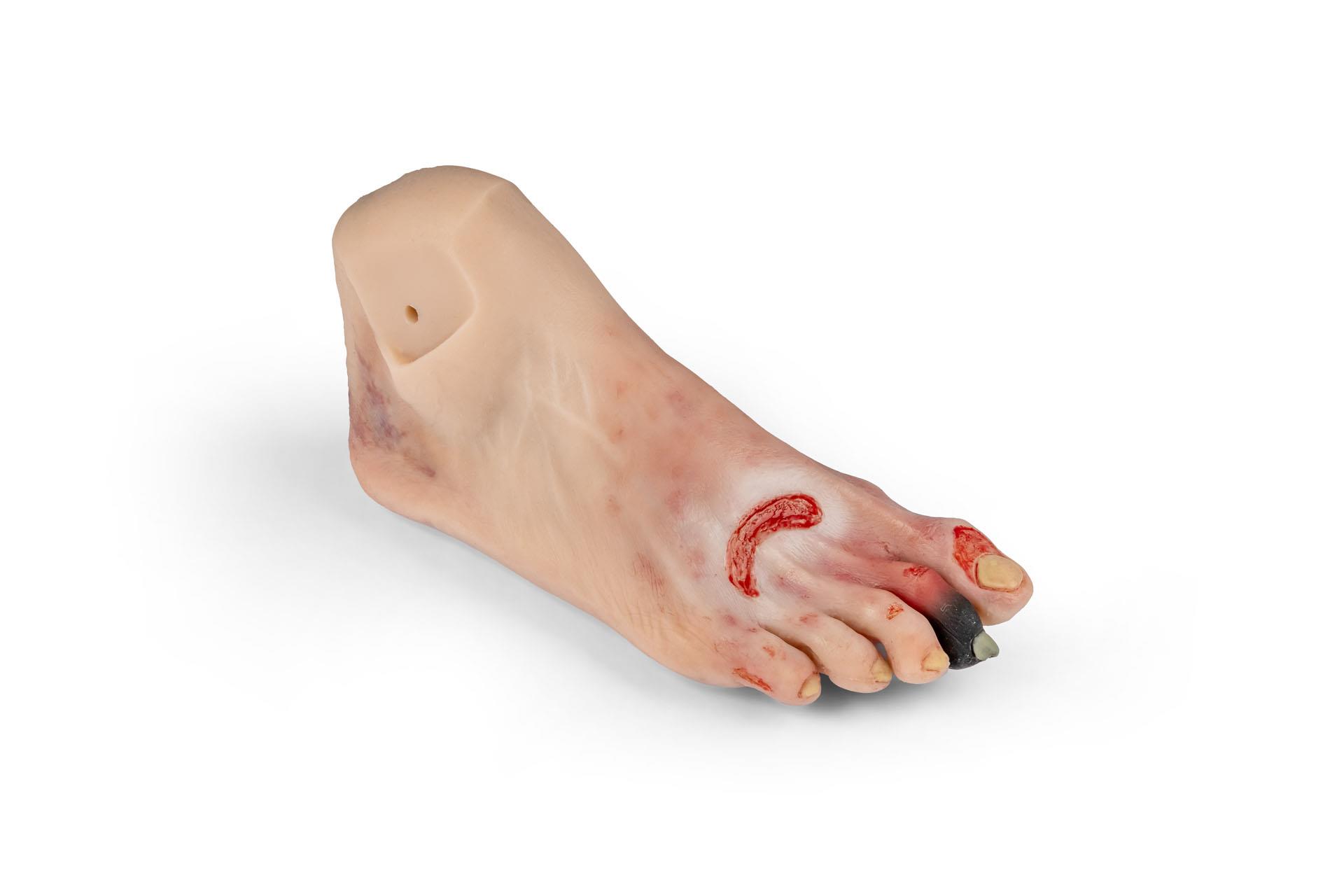 Wound-foot-with-diabetic-foot-syndrome-manikin-version