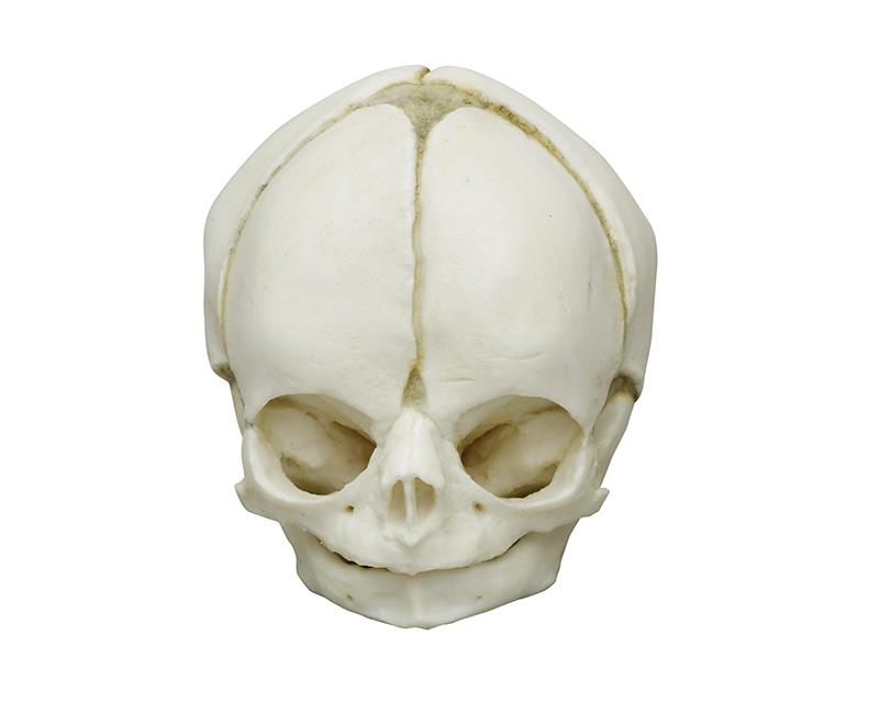 Fetal skull 29 weeks