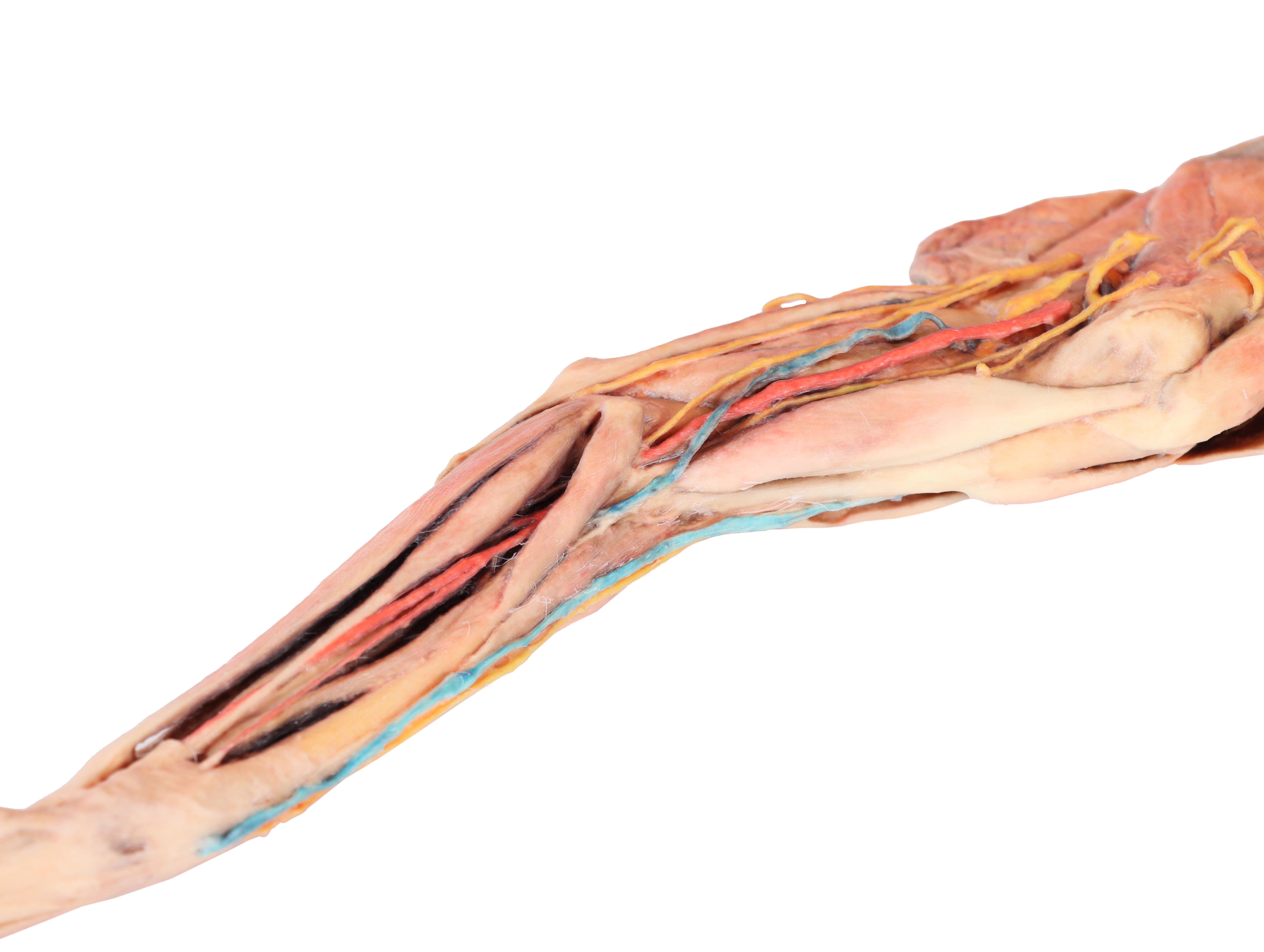 Dog-forelimb---muscles,-tendons,-ligaments,-vessels-and-nerves-distal-to-the-elbow-5