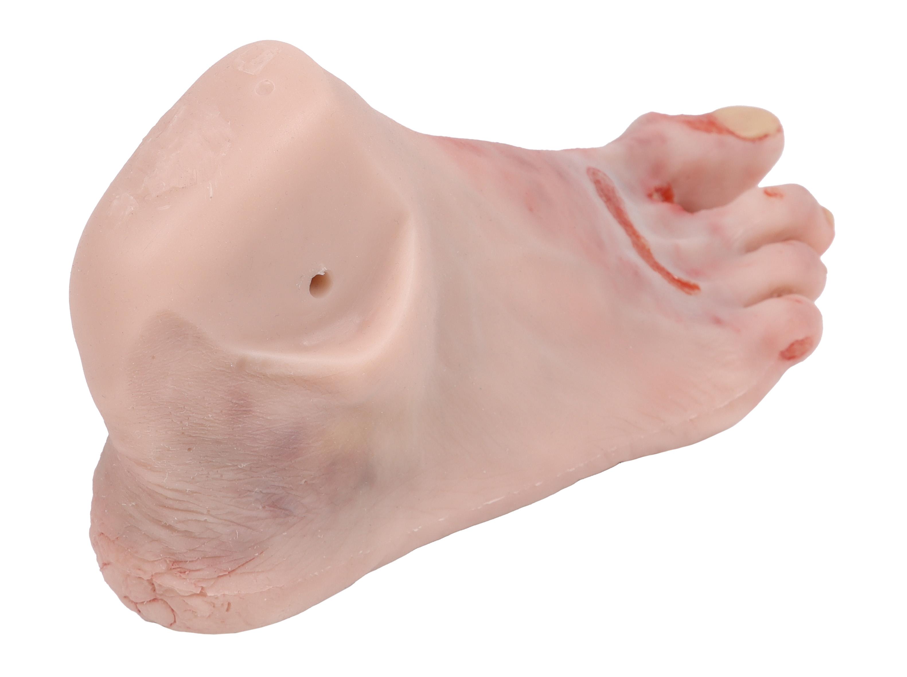 Wound-foot-with-diabetic-foot-syndrome-severe-stage-manikin-version-1