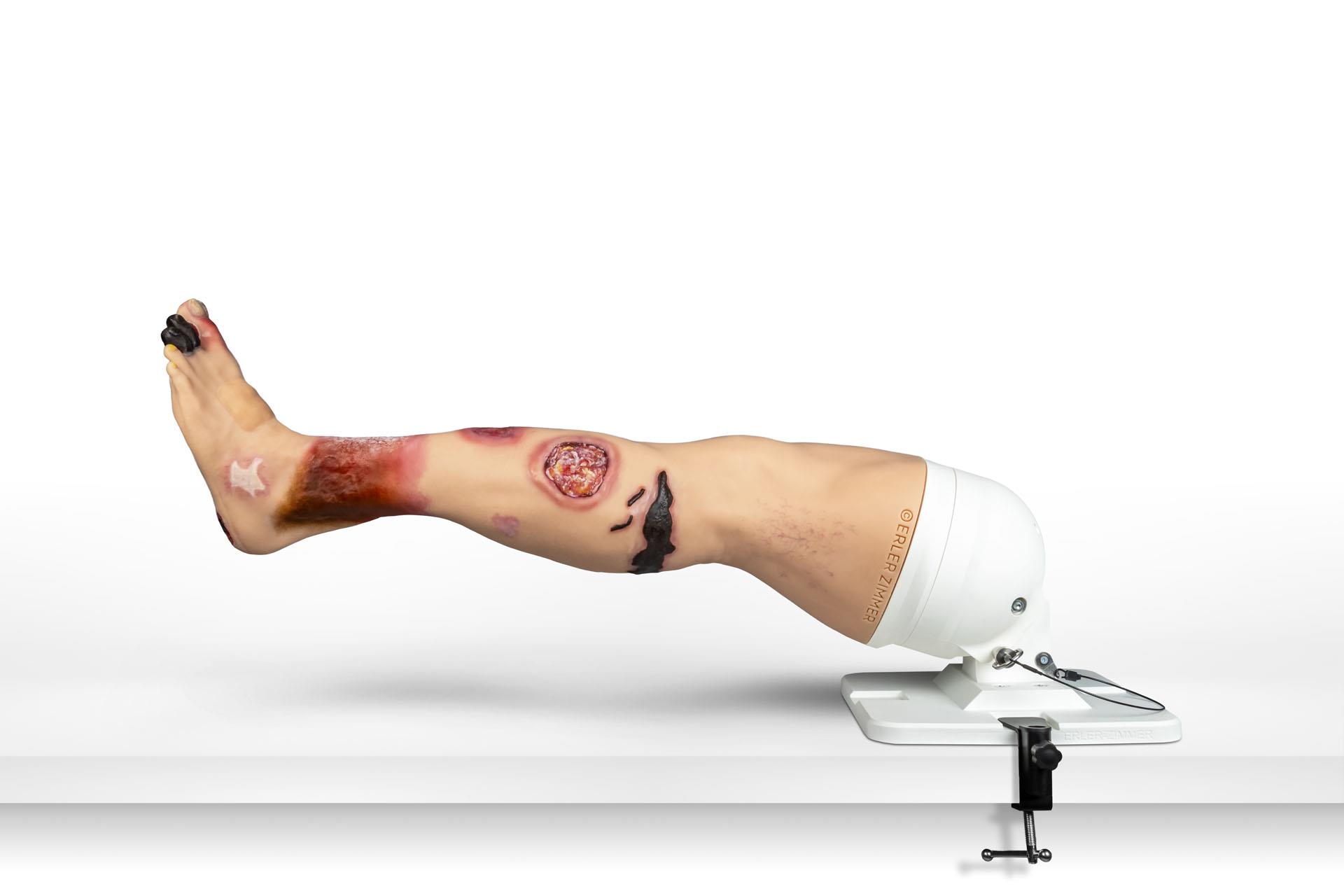 Lena-Leg-Jambe-atteinte-de-maladies-12
