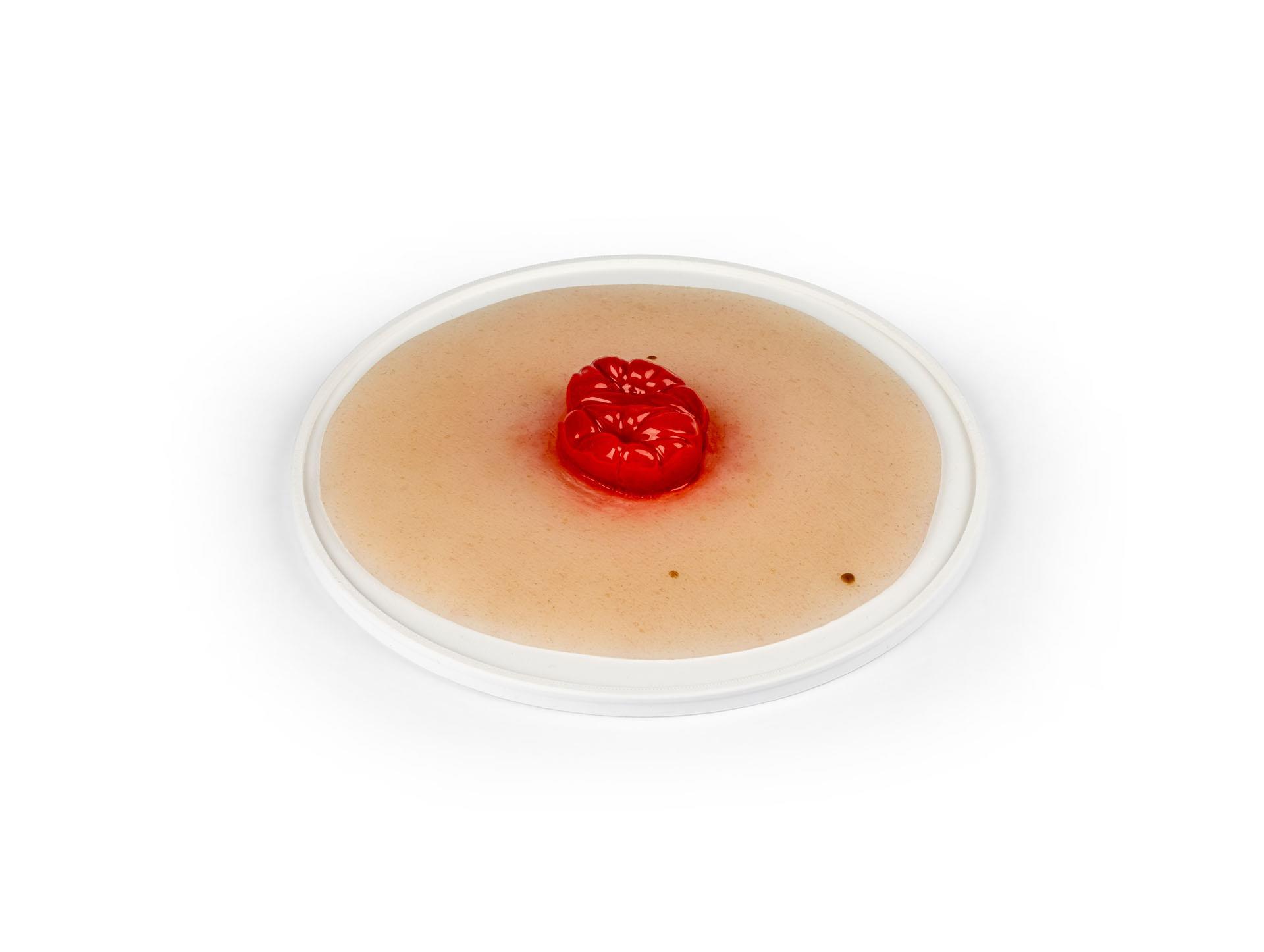 Wound-moulage-colostomy-double-barrel-self-adhesive