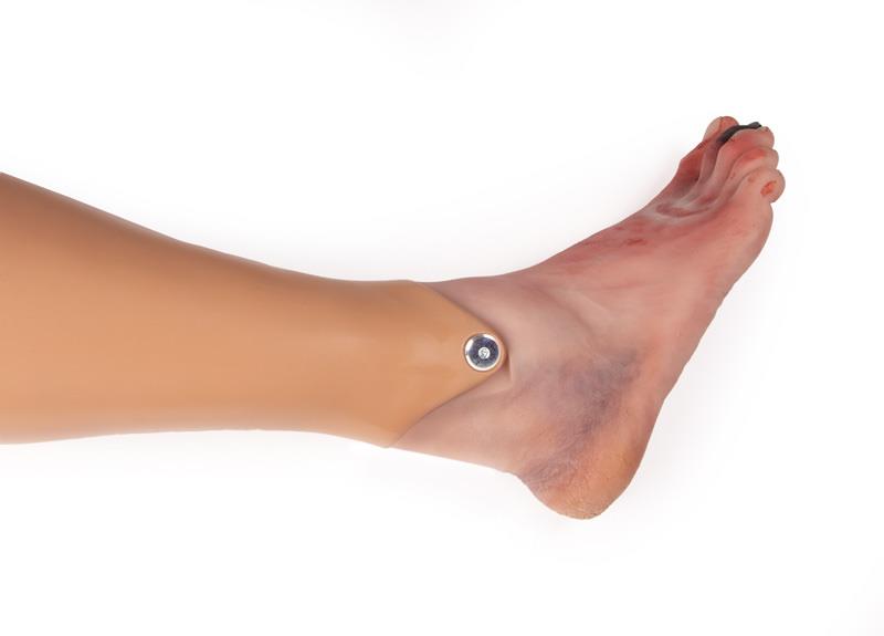 Wound-foot-with-diabetic-foot-syndrome-manikin-version-1