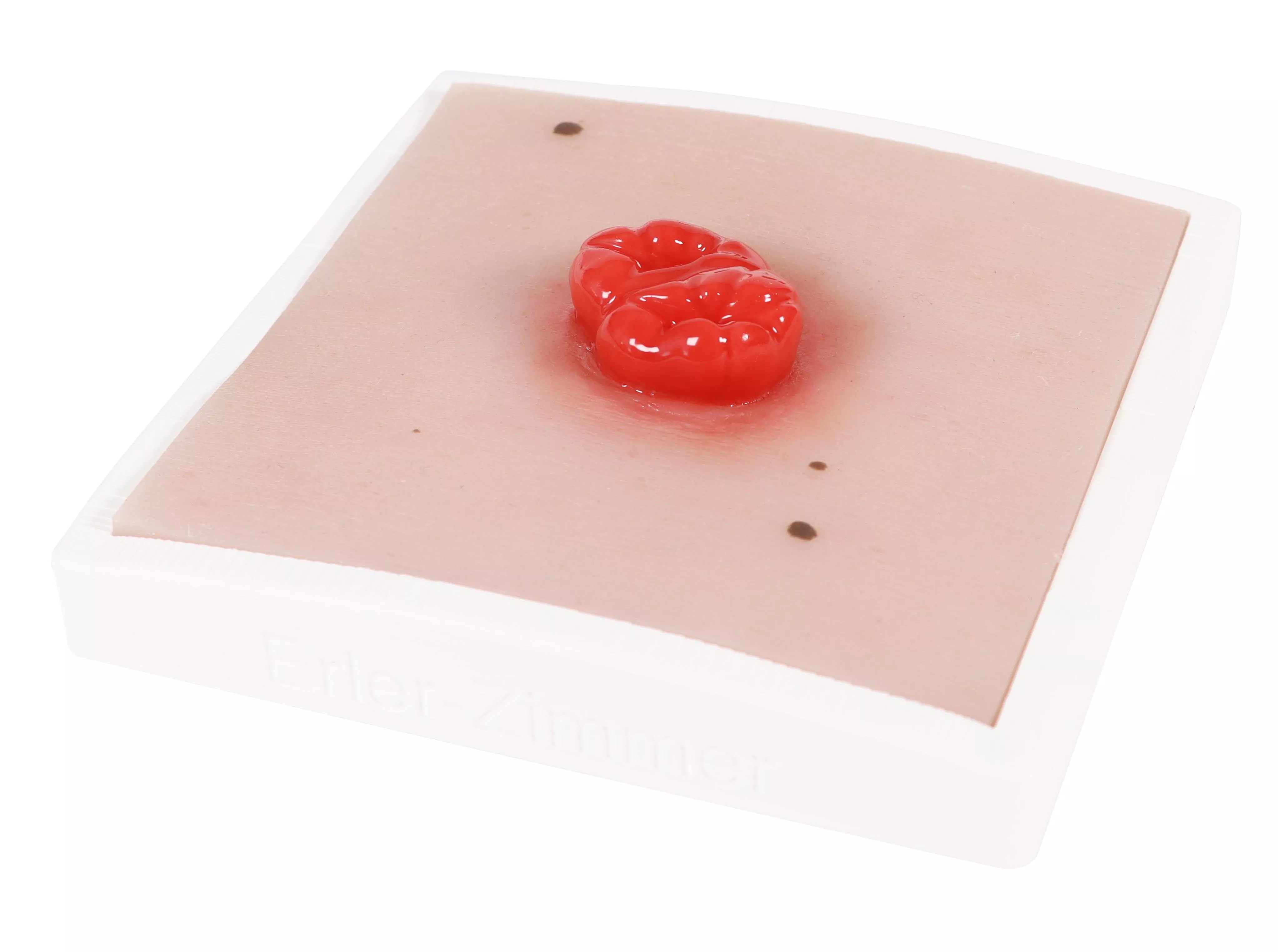 Moulage-de-plaie-colostomie-double,-y-compris-base-1