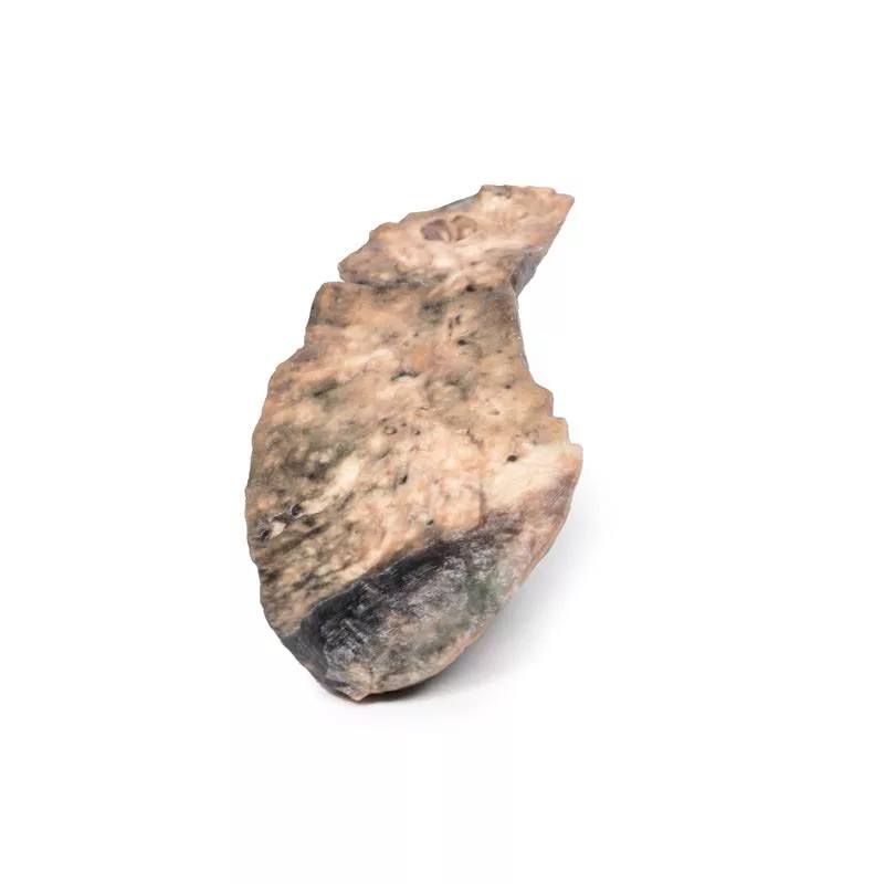 Lung—Cystic Fibrosis