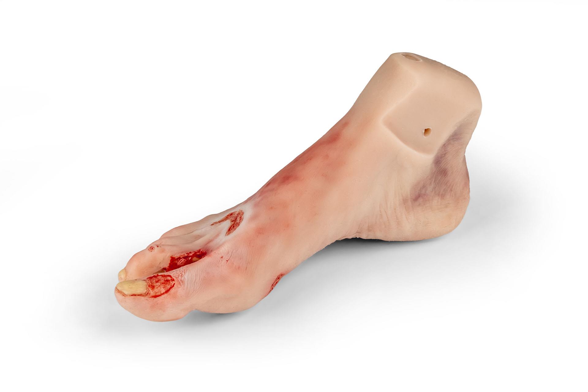 Wound-foot-with-diabetic-foot-syndrome-severe-stage-manikin-version-2