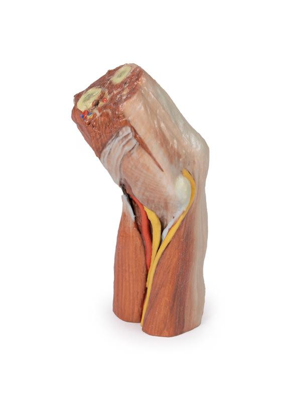 Fossa cubitalis – Muskeln, große Nerven und die Arteria brachialis