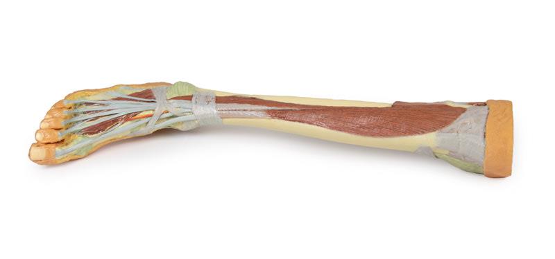 Lower Limb - deep dissection