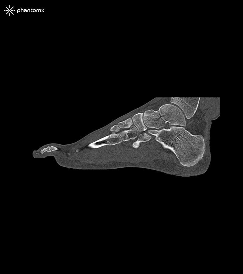 Fußphantom-für-CT-Röntgen-und-Strahlentherapie-2