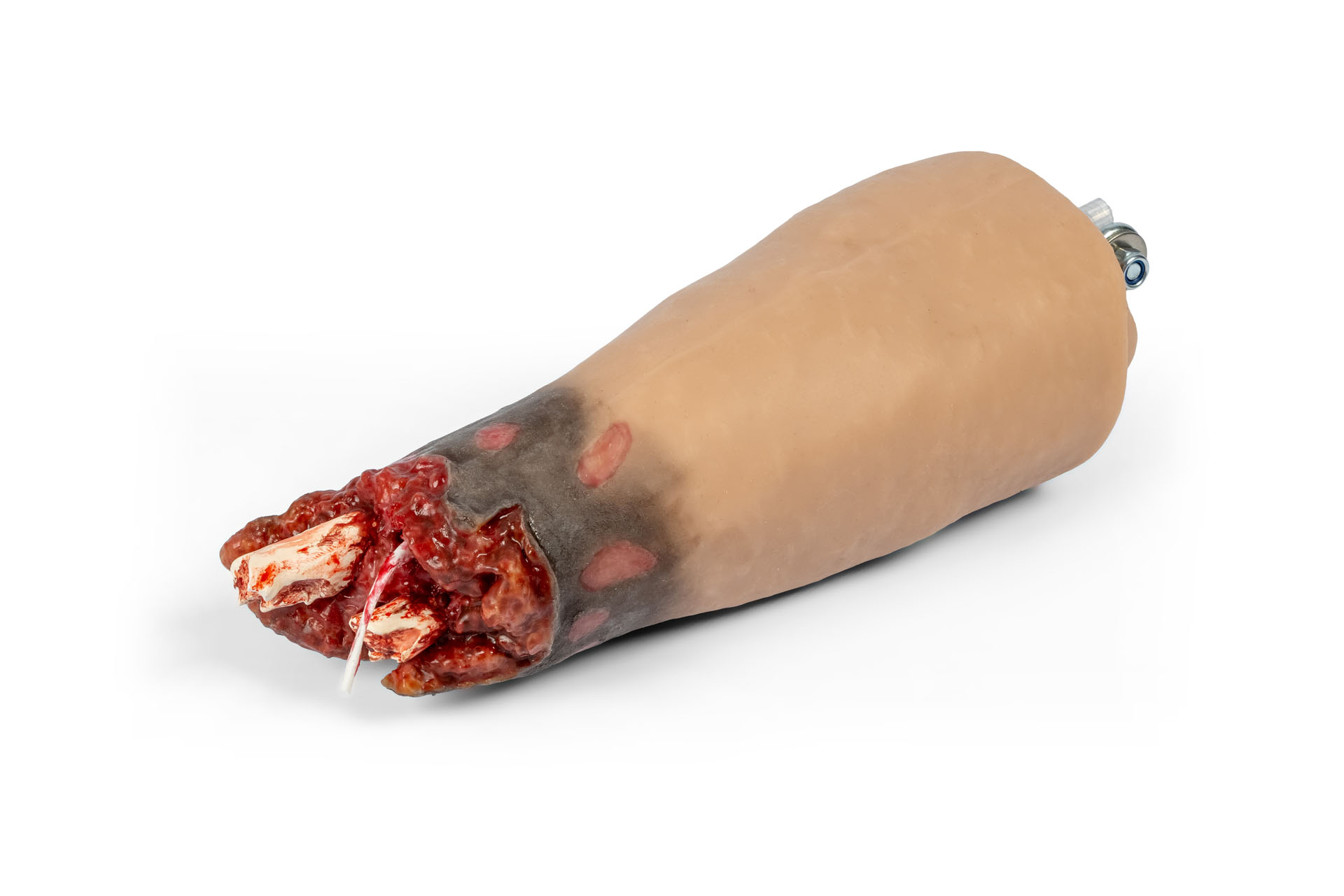 Amputationsstumpf Arm rechts, Combat Carl