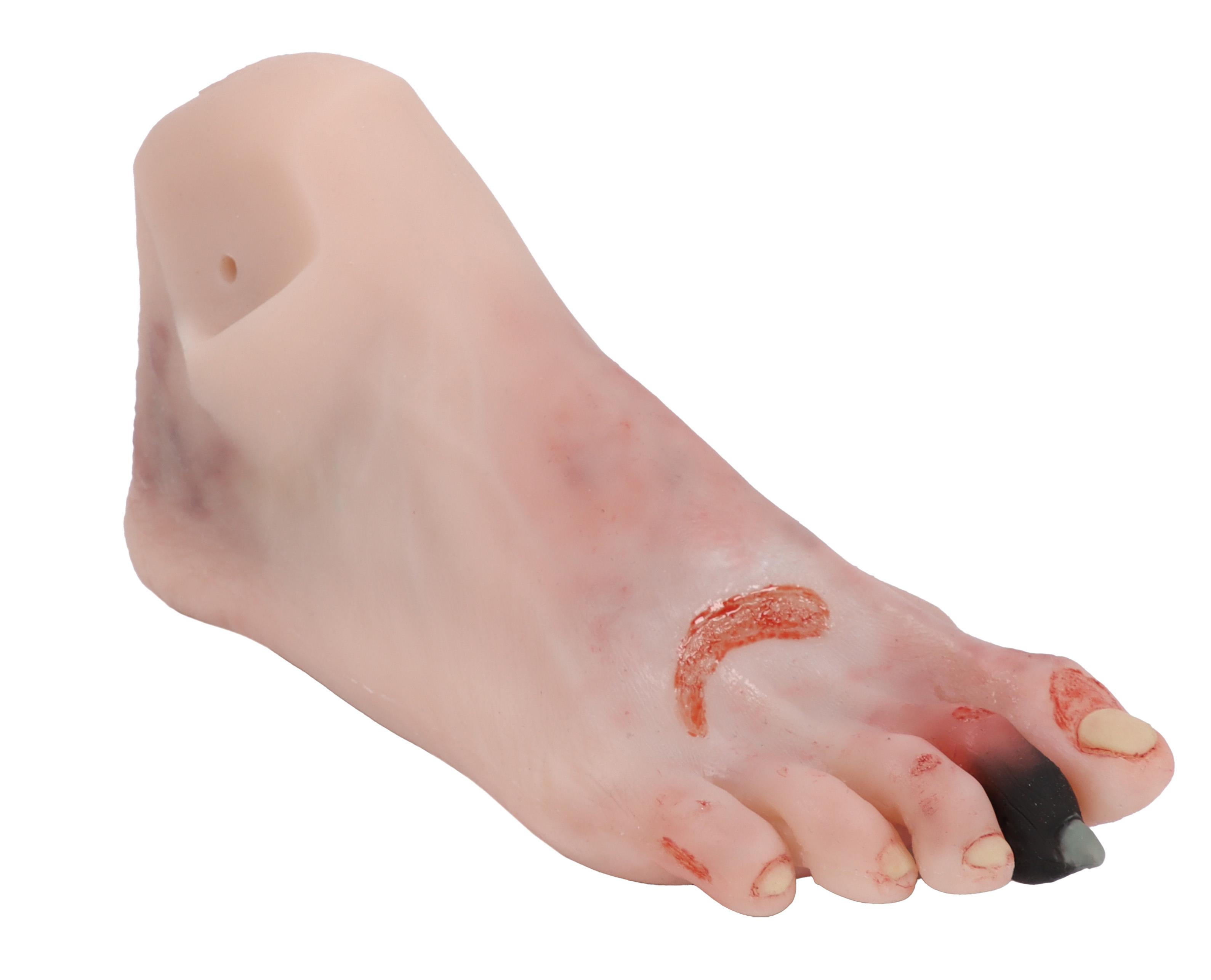 Wound-foot-with-diabetic-foot-syndrome-manikin-version