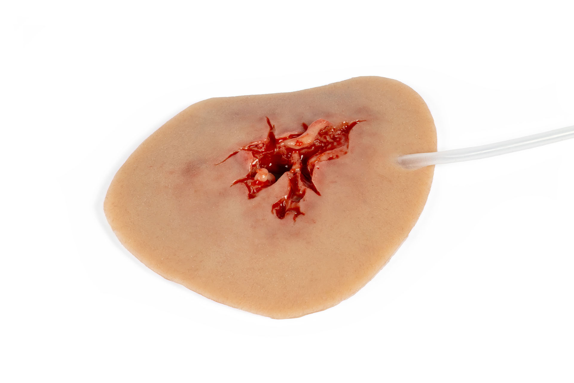 Wound Moulage Groin Injury 