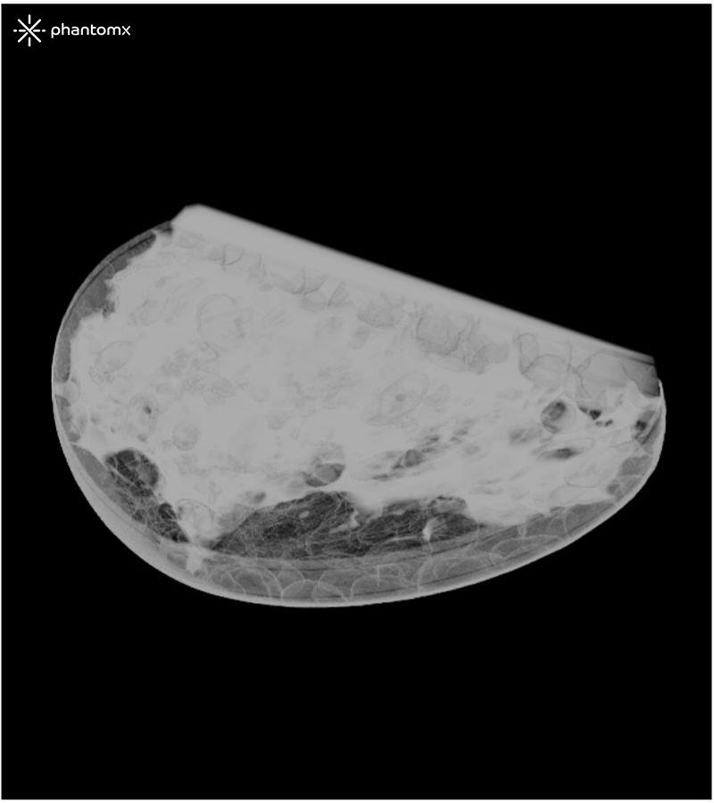 Brustphantom-für-Mammographie-und-Brusttomosynthese-2