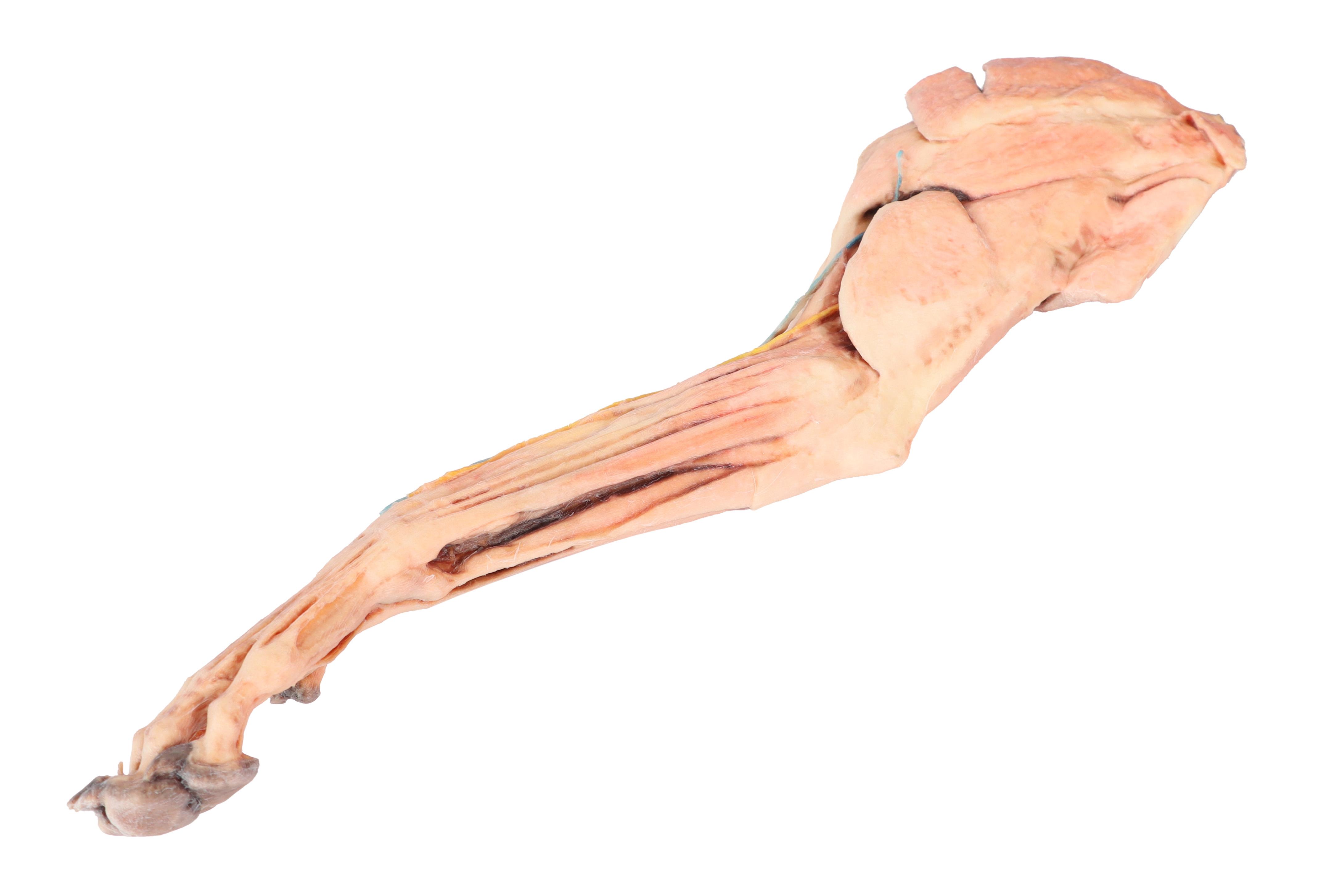 Dog-forelimb---muscles,-tendons,-ligaments,-vessels-and-nerves-distal-to-the-elbow-1