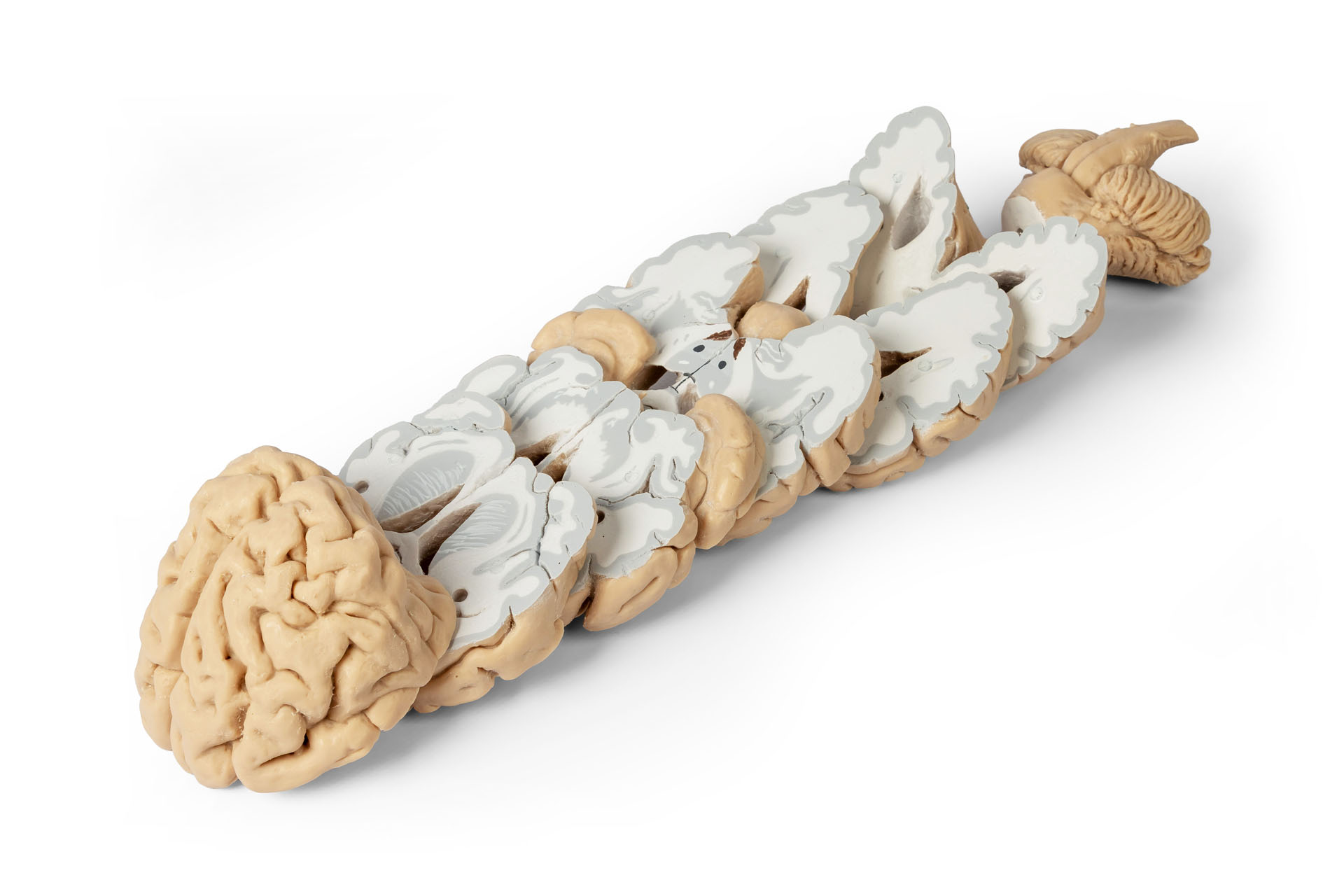 Menschliches Gehirn in Frontalschnitten