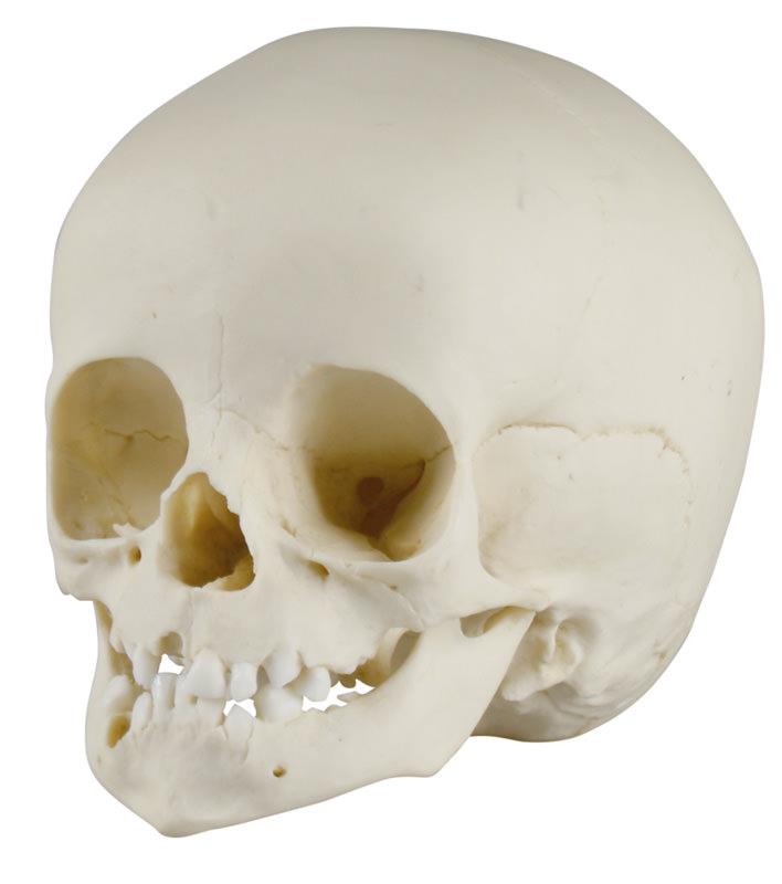 Child skull, 14 months old