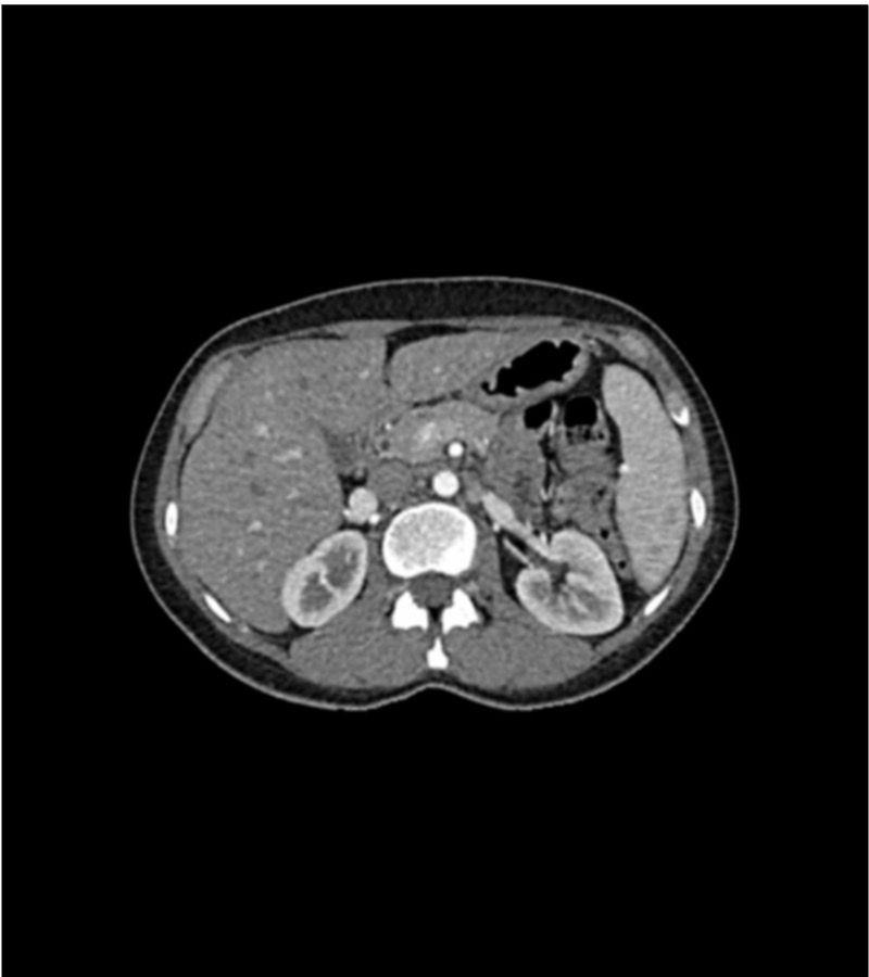 Abdomen-Phantom-für-CT-Röntgen-und-Strahlentherapie-2