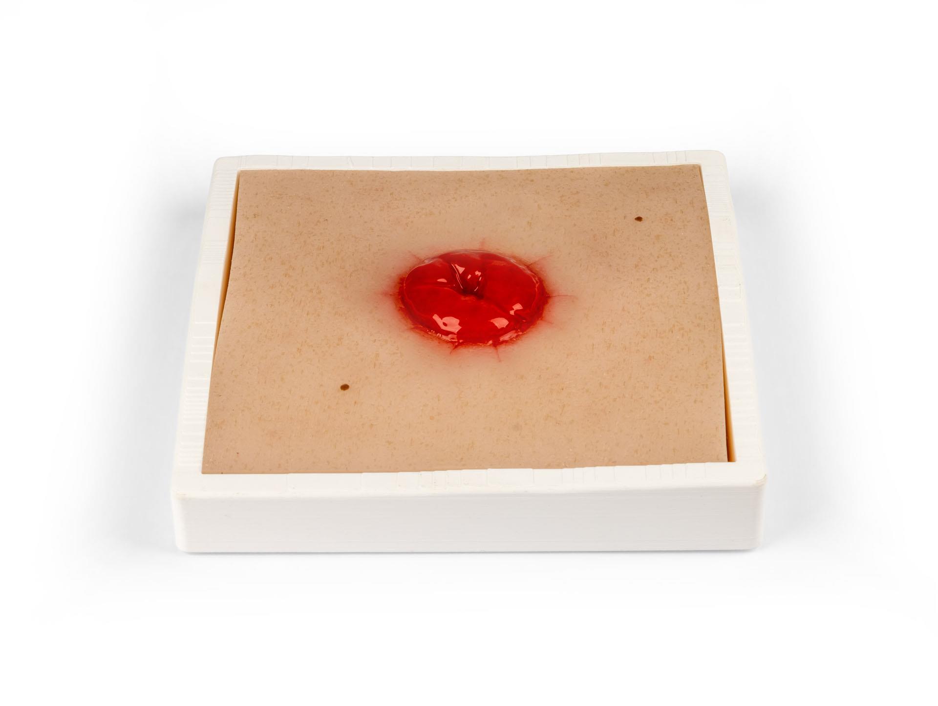 Wound-Moulage-Colostoma-incl-stand-1