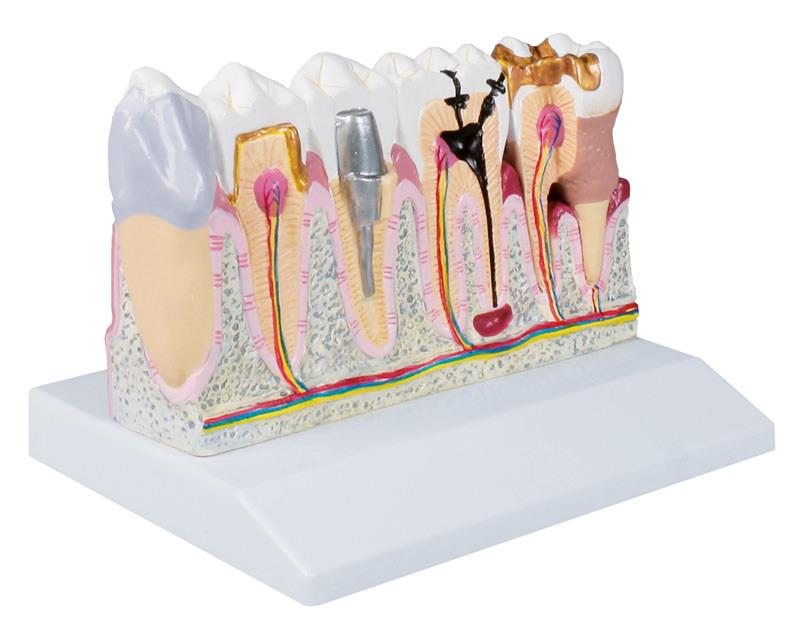 Dental model, 4 times life size - EZ Augmented Anatomy