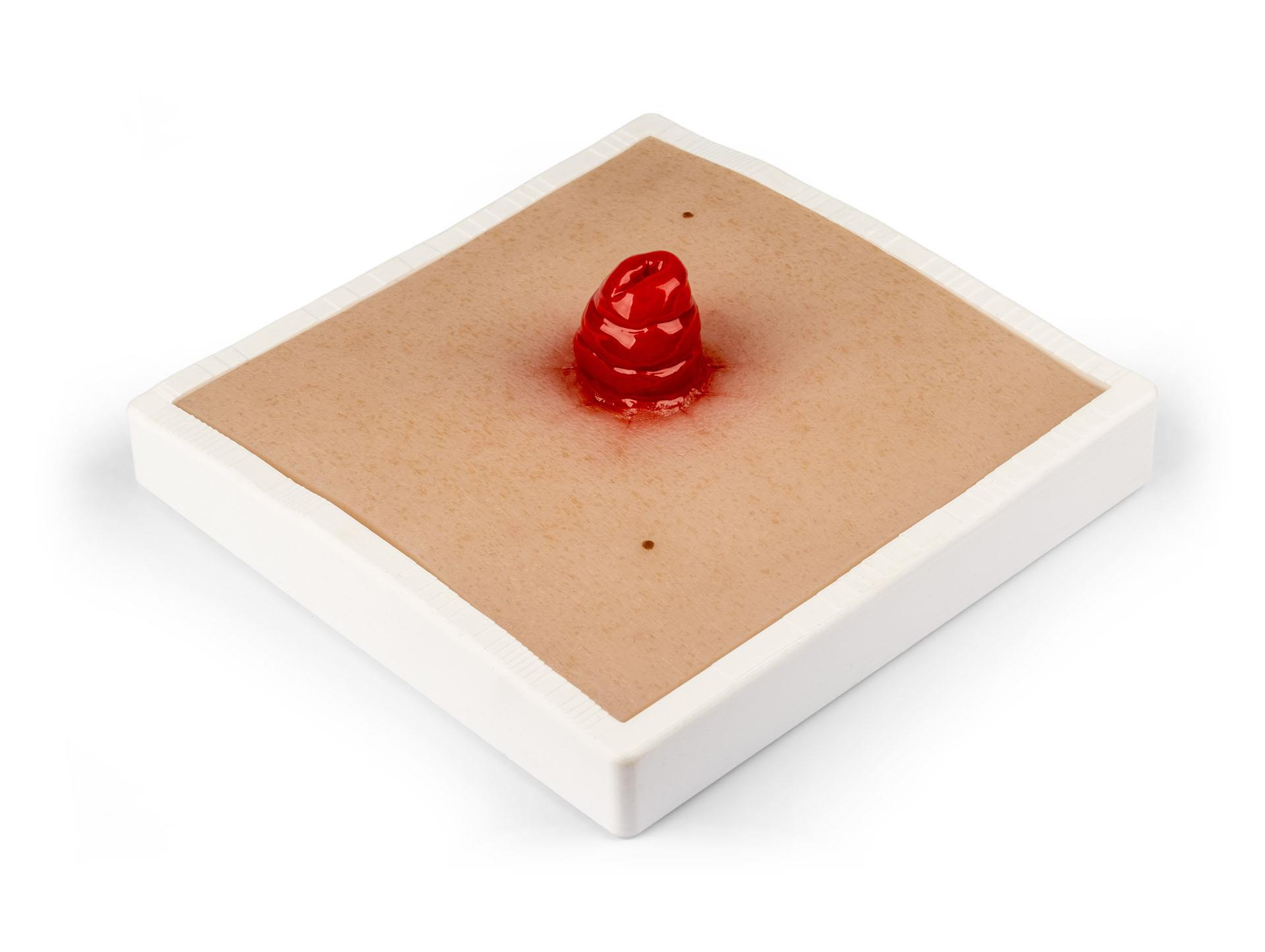Wound-Moulage-Ileostoma-incl-stand