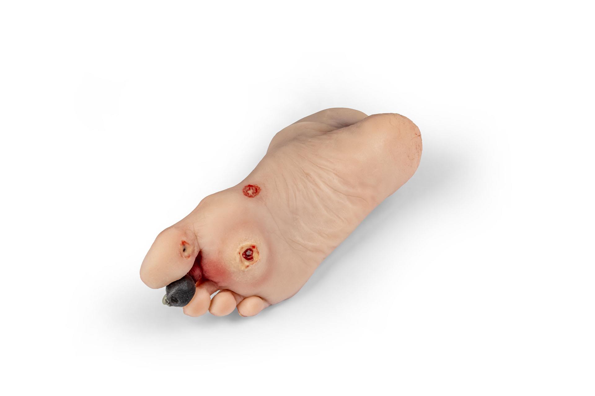 Wound-foot-with-diabetic-foot-syndrome-manikin-version-3