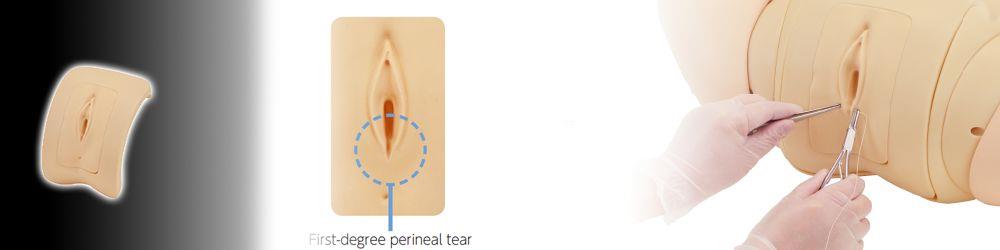 Module for Hana - Perineal tear module
