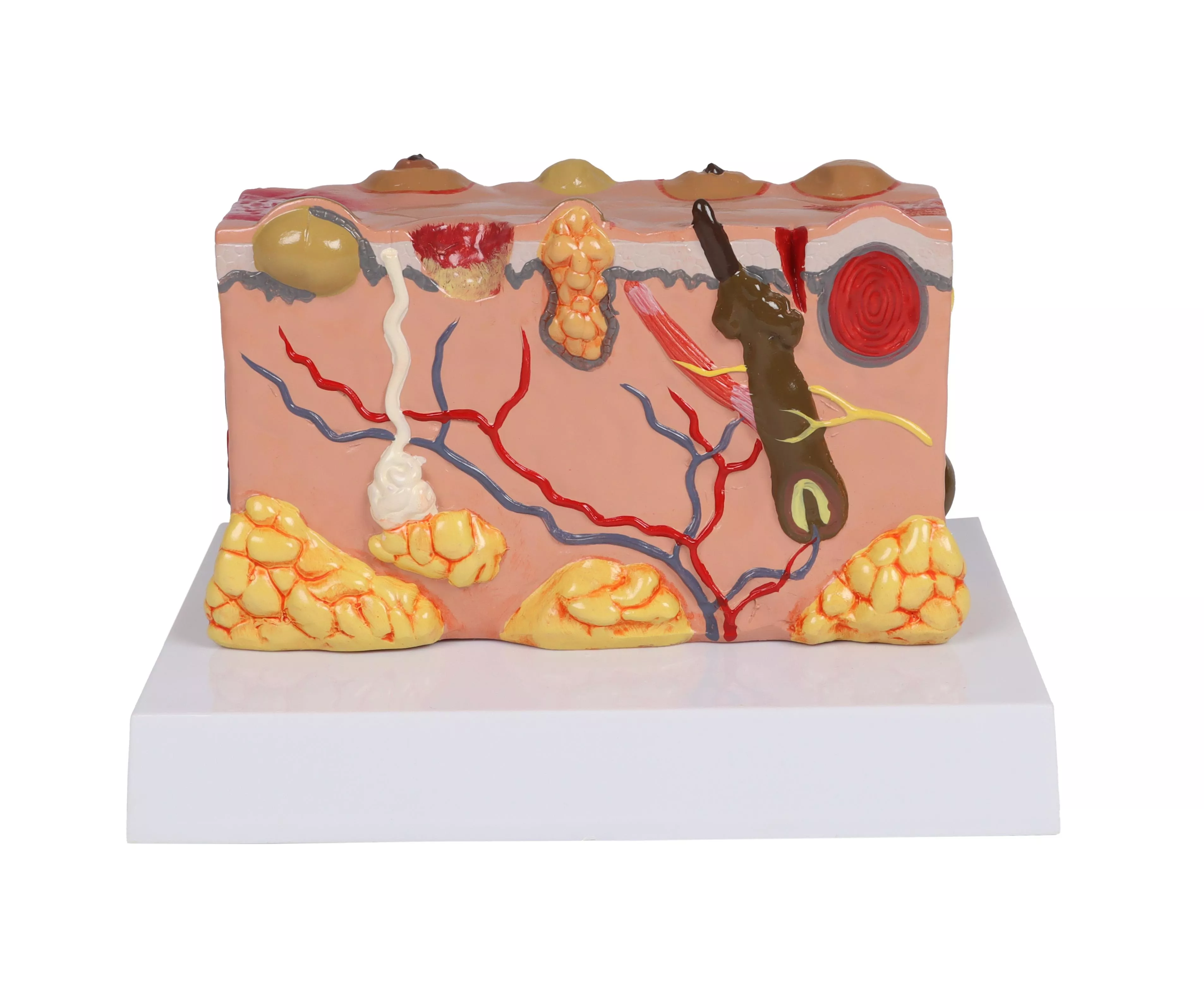 Pathologisches-Hautmodell-2