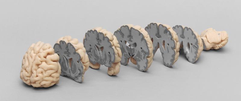 Human Brain Multiple Frontal Sections