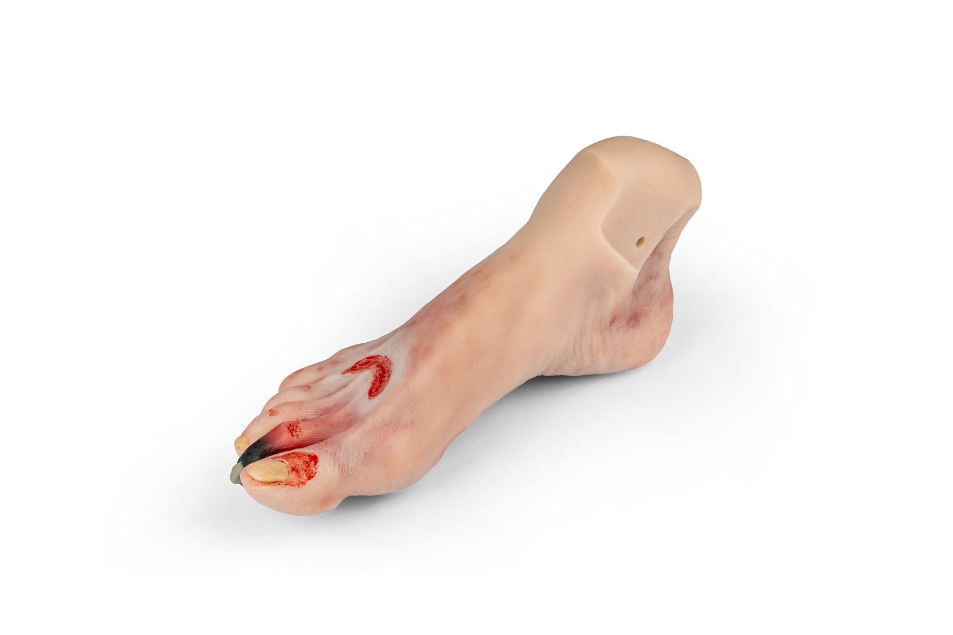 Wound-foot-with-diabetic-foot-syndrome-manikin-version-2