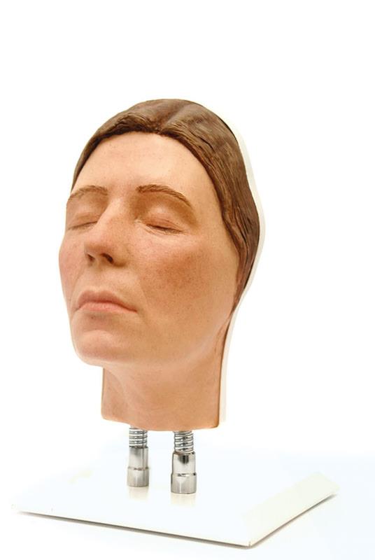 Head for facial injections, version E