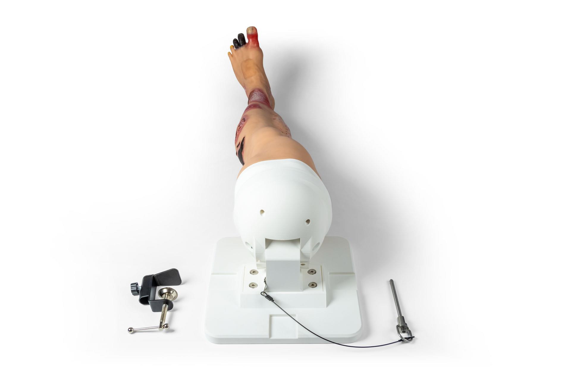Lena-Leg-Jambe-atteinte-de-maladies-2
