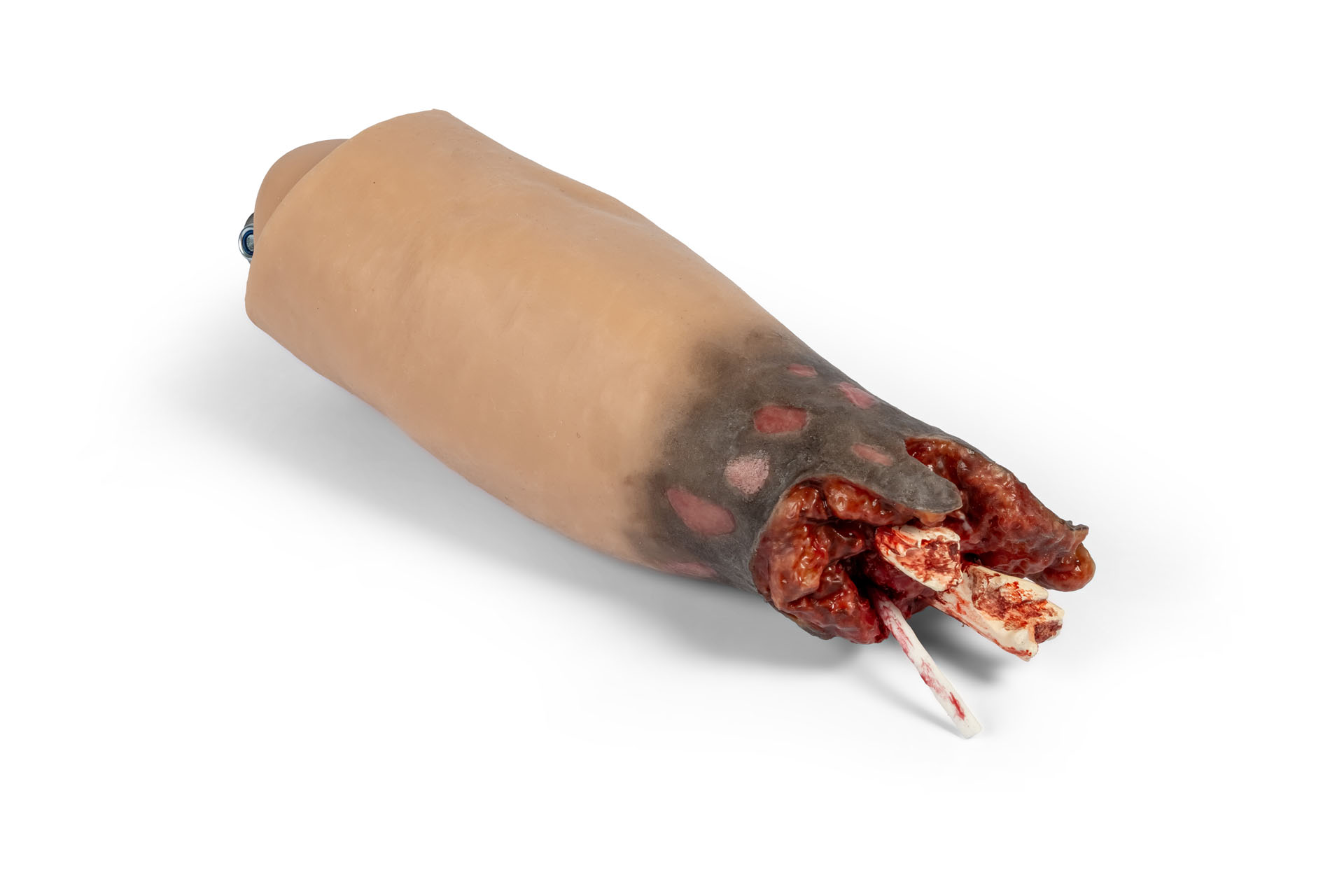 Amputationsstumpf Arm rechts, Combat Carl