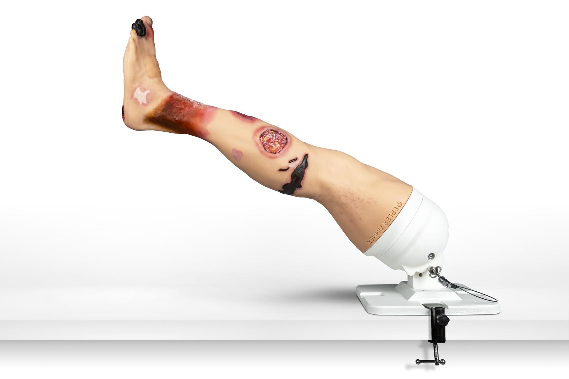Lena-Leg-Jambe-atteinte-de-maladies-13