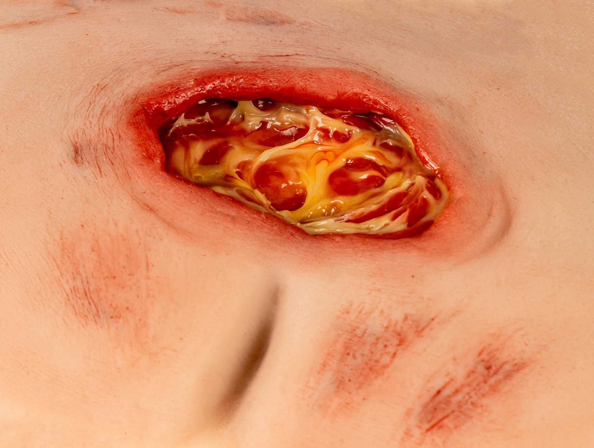 Wound-moulage-sacral-decubitus-cleaned-4
