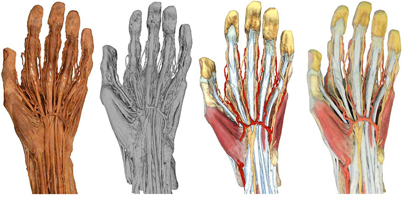 3D Anatomie Modelle