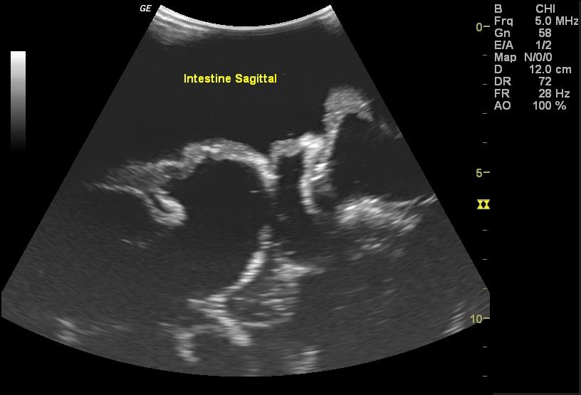 Adult-Torso-for-X-Ray-CT-and-US-9 Adult-Torso-for-X-Ray-CT-and-US-9
