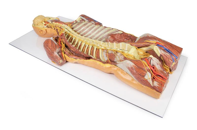 Posterior Body Wall / Ventral Deep Dissection