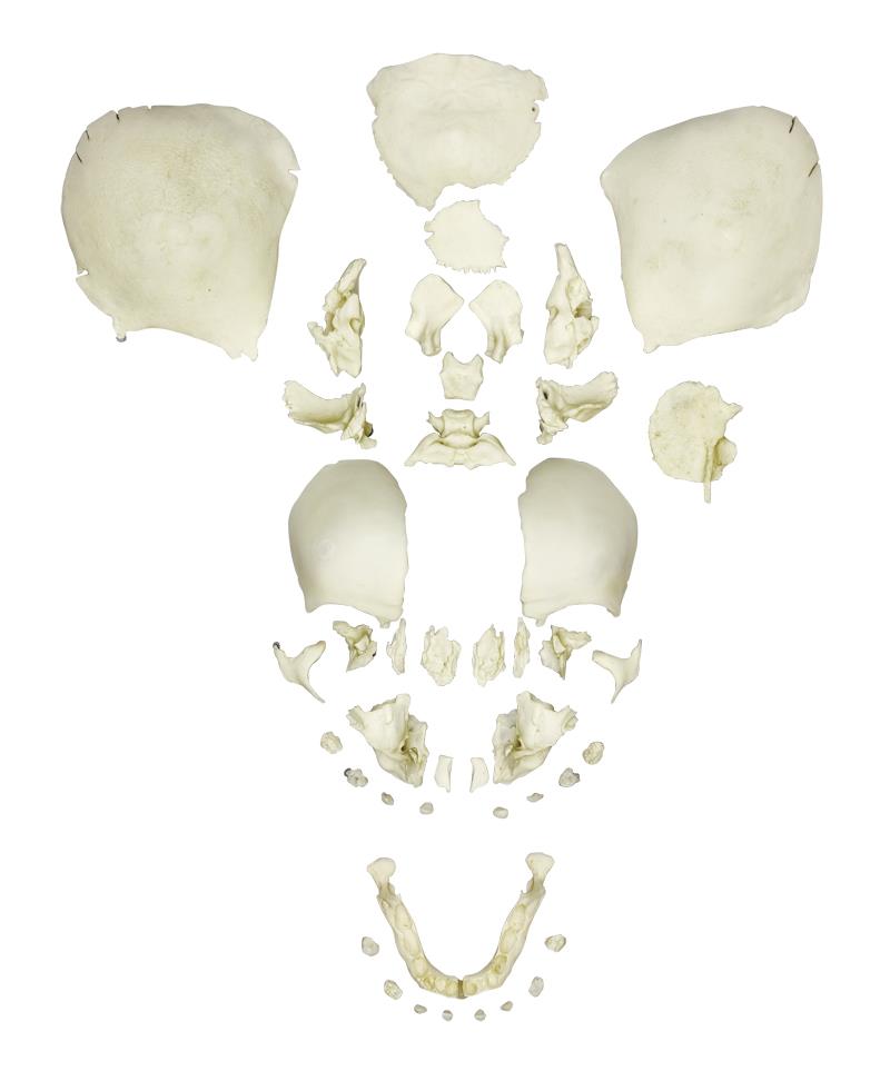 Disarticulated Human Fetal Skull, Full Term