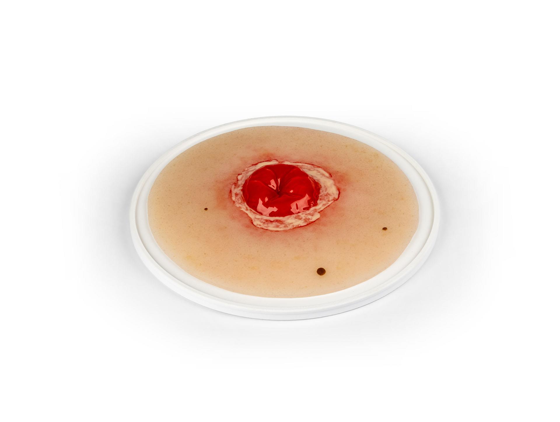 Wound-moulage-Colostomy-inflamed-self-adhesive